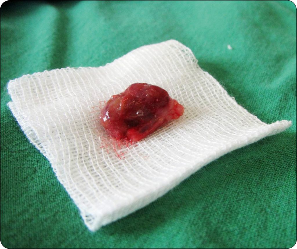 WWP_1_2_18_NADCZYNNOSC_TARCZYCY_U_KOTOW_RYC_2