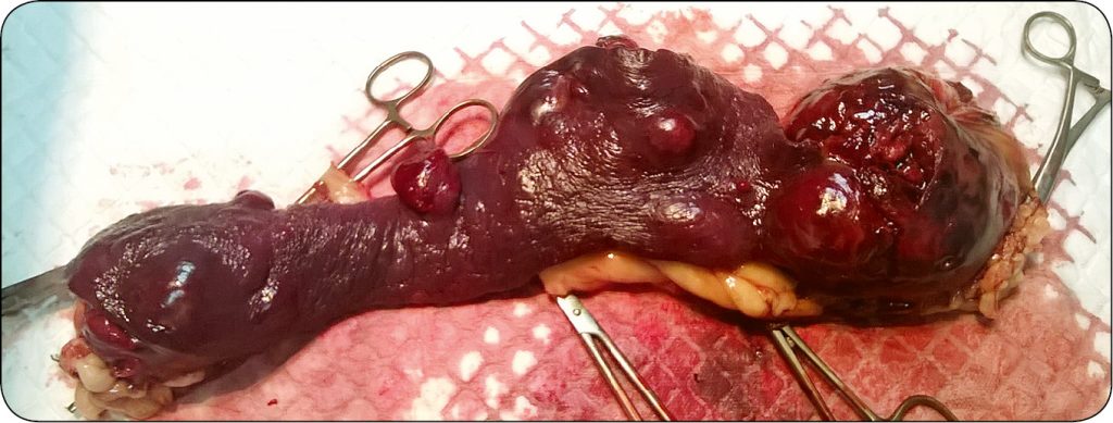 WWP_4_18_HEMANGIOSARCOMA_MASKOWANA_PRZEZ_BABESIOSIS_CANUM_RYC_3 śledziony