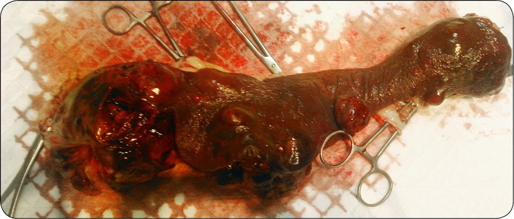 WWP_4_18_HEMANGIOSARCOMA_MASKOWANA_PRZEZ_BABESIOSIS_CANUM_RYC_5 śledziony