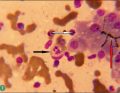 WWP_6_18_NIETYPOWY_PRZEBIEG_ANAPLAZMOZY_RYC_7