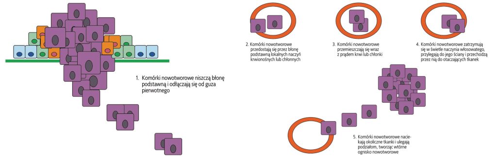 WWP_7_8_18_OKRESLENIE_STOPNIA_ZAAWANSOWANIA_KLINICZNEGO_RYC_3_3
