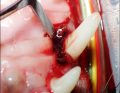 WWP_7_8_18_RACJONALNE_STOSOWANIE_ANTYBIOTYKOW_W_STOMATOLOGII_RYC_4_G