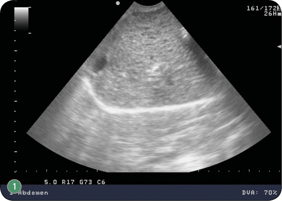 WWP_9_18_CHLONIAK_WATROBY_U_PSA_RYC_1