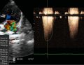 WWP_10_18_NADCISNIENIE_TETNICZE_RYC_6