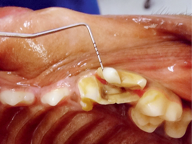 WWP_7_8_19_ZLAMANIA_ZEBOW_U_PSOW_RYC_1 złamania zębów