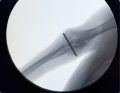 WWP_10_19_ZASTOSOWANIE_FLUOROSKOPII_RYC_3