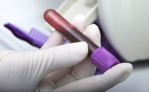 Trwają prace nad badaniami kontrolnymi krwi dla psów