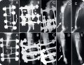 WWP_10_17_LECZENIE_BRAKU_ZROSTU_CZ_2_RYC_2