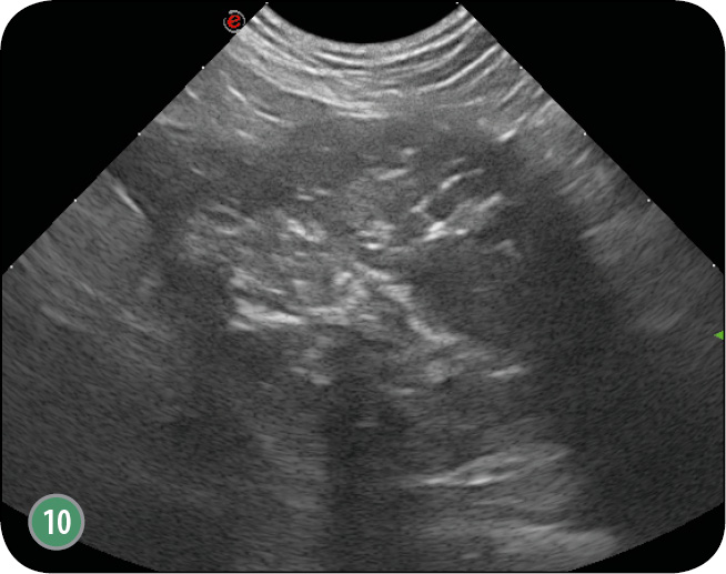 WWP_6_17_OCENA_RADIOLOGICZNA_ORAZ_USG_RYC_10 gruczołu krokowego