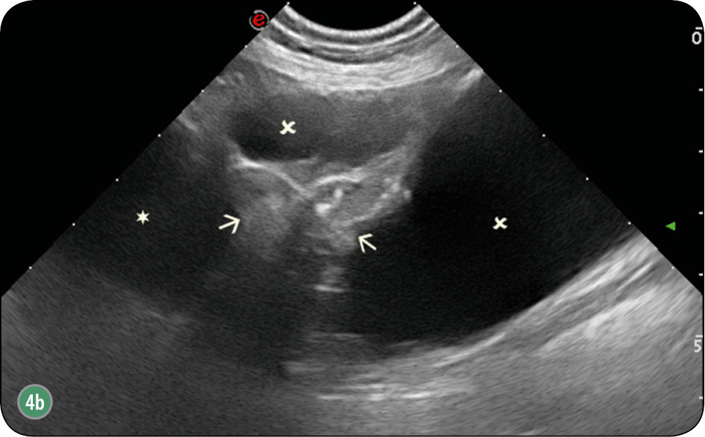 WWP_6_17_OCENA_RADIOLOGICZNA_ORAZ_USG_RYC_4_B gruczołu krokowego
