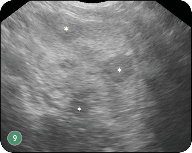 WWP_6_17_OCENA_RADIOLOGICZNA_ORAZ_USG_RYC_9 gruczołu krokowego