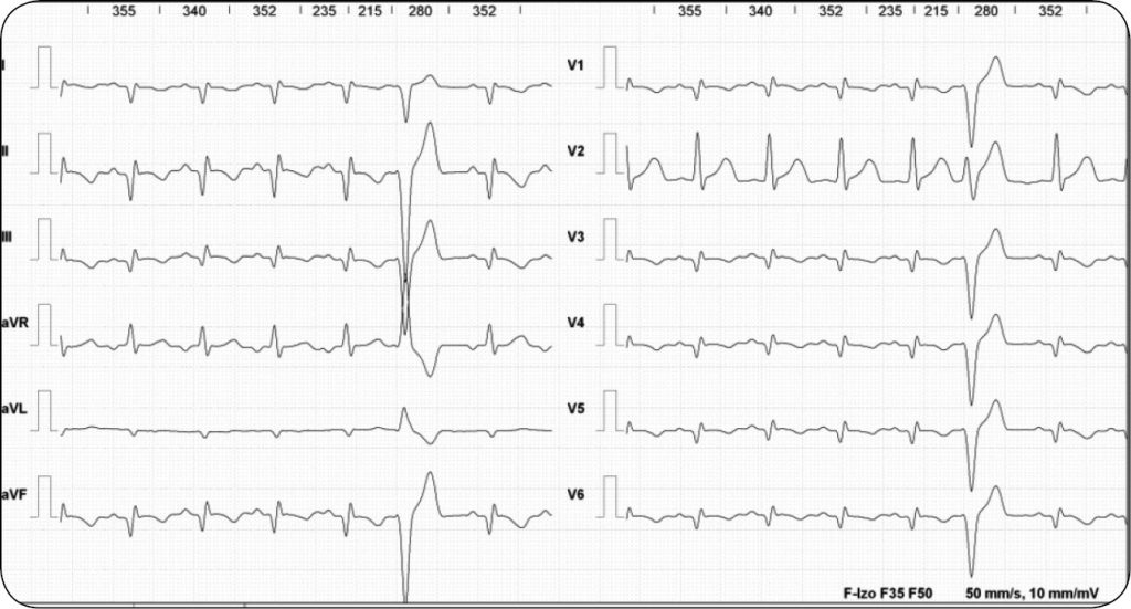 WWP_3_17_ZABURZENIA_KARDIOLOGICZNE_RYC_2 canis