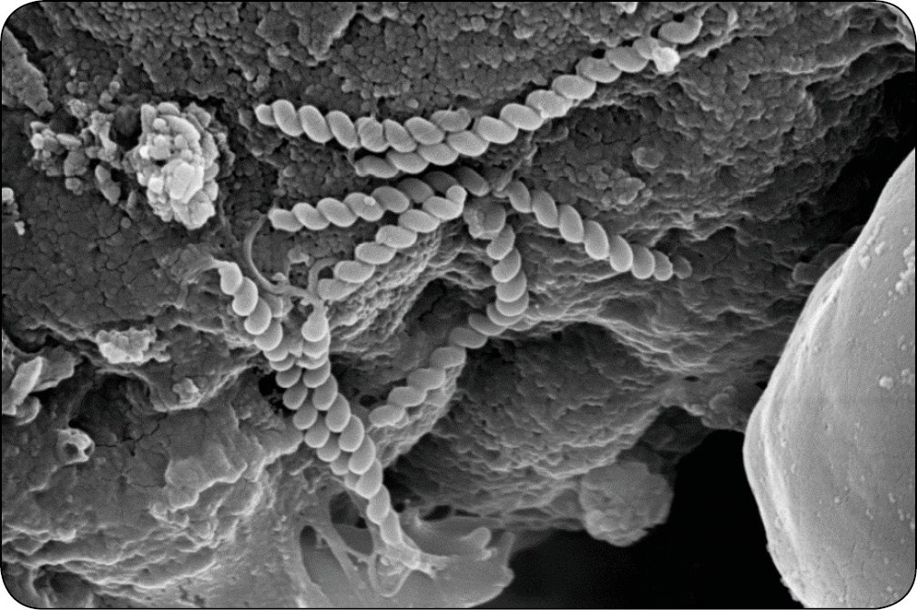 WWP_7_8_16_HELICOBACTER_W_ZOLADKU_RYC_2 helicobacter spp.