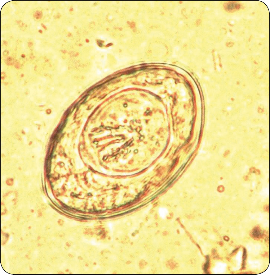 WWP_9_16_DIAGNOSTYKA_I_LECZENIE_PASOZYTOW_RYC_4 pasożytów