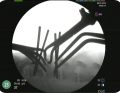 WWP_5_20_chirurgia_FLUOROSKOPIA_SRODOPERACYJNA_W_ORTOPEDII_RYC_23