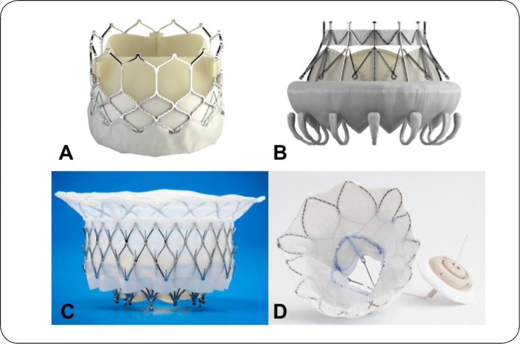 KARDIO_20_kardiologia__Postępy w kardiochirurgii i kardiologii interwencyjnej u psów_ryc_6
