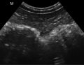 WWP_4_15_diagnostyka_BADANIE_USG_JELITA_GRUBEGO_RYC_3