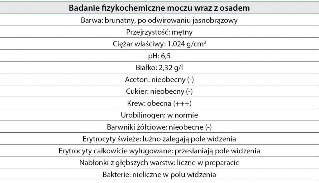 WWP_5_13_Maciej_Grzegory_ROZPOZNAWANIE_CHOROB_PECHERZA_MOCZOWEGO_TAB_8