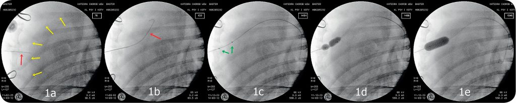 WWP_11-12_12_LECZENIE_PRZEWLEKLEGO_WYSIEKU_OSIERDZIOWEGO_RYC_1