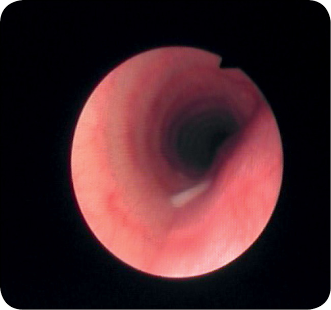 WWP_11-12_12_Jolanta_Spuzak_ZABUZENIA_ODDECHOWE_U_PSOW_RYC_2