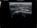 WWP_3_13_Michal_Jankowski_OCENA_URAZOW_STAWU_BIODROWEGO_I_KOSCI_MIEDNICZNYCH_RYC_2