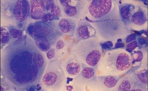 WWP_11_12_Robin_W_Allison_RODZAJE_KOMOREK_W_BADANIACH_CYTOLOGICZNYCH_RYC_17
