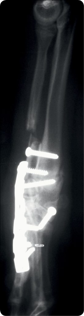 WWP_4_12_Piotr_Trebacz_OPERACYJNE_LECZENIE_ROZSZCZEPU_DLONI_I_NADGARSTKA_RYC_6