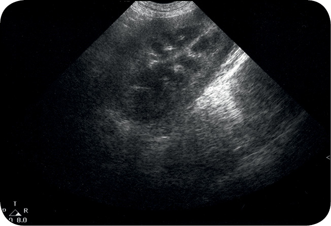 WWP_5_12_Lukasz_Gliszczynski_PRZEWLEKLA_PROMIENICA_JAMY_BRZUSZNEJ_U_PSA_RYC_12