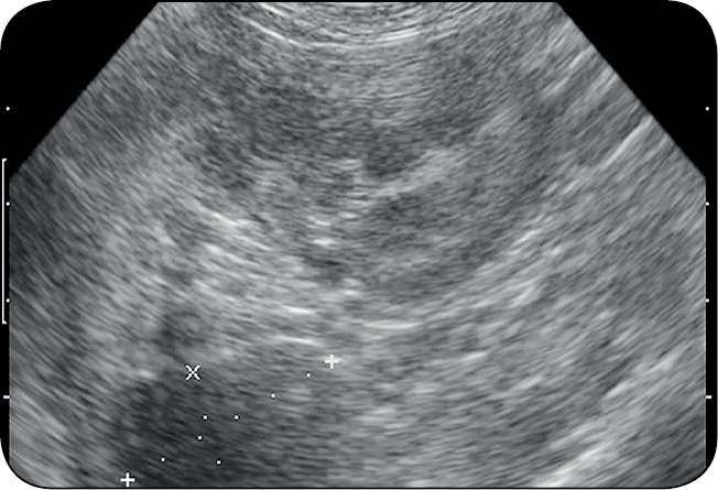 WWP_5_12_Lukasz_Gliszczynski_PRZEWLEKLA_PROMIENICA_JAMY_BRZUSZNEJ_U_PSA_RYC_4