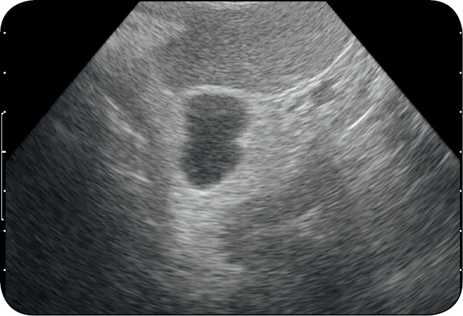 WWP_5_12_Lukasz_Gliszczynski_PRZEWLEKLA_PROMIENICA_JAMY_BRZUSZNEJ_U_PSA_RYC_6