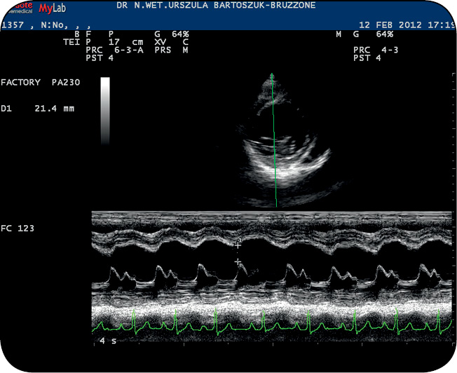Kardiomiopatia rozstrzeniowa WWP_9_12_Urszula_Bartoszuk-Bruzzone_KARDIOMIOPATIA_ROSTRZENIOWA_U_PSOW_RYC_1 Kardiomiopatia rozstrzeniowa