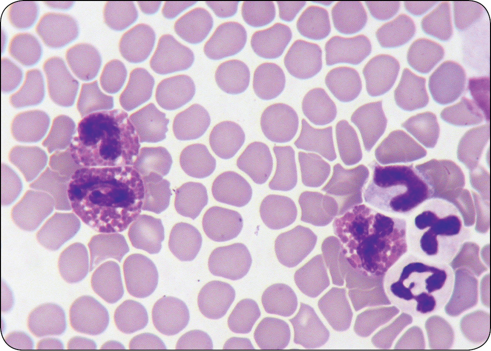 WWP_10_11_Janina_Lukaszewska_ZESPOLY_PARANOWOTWOROWE_RYC_2