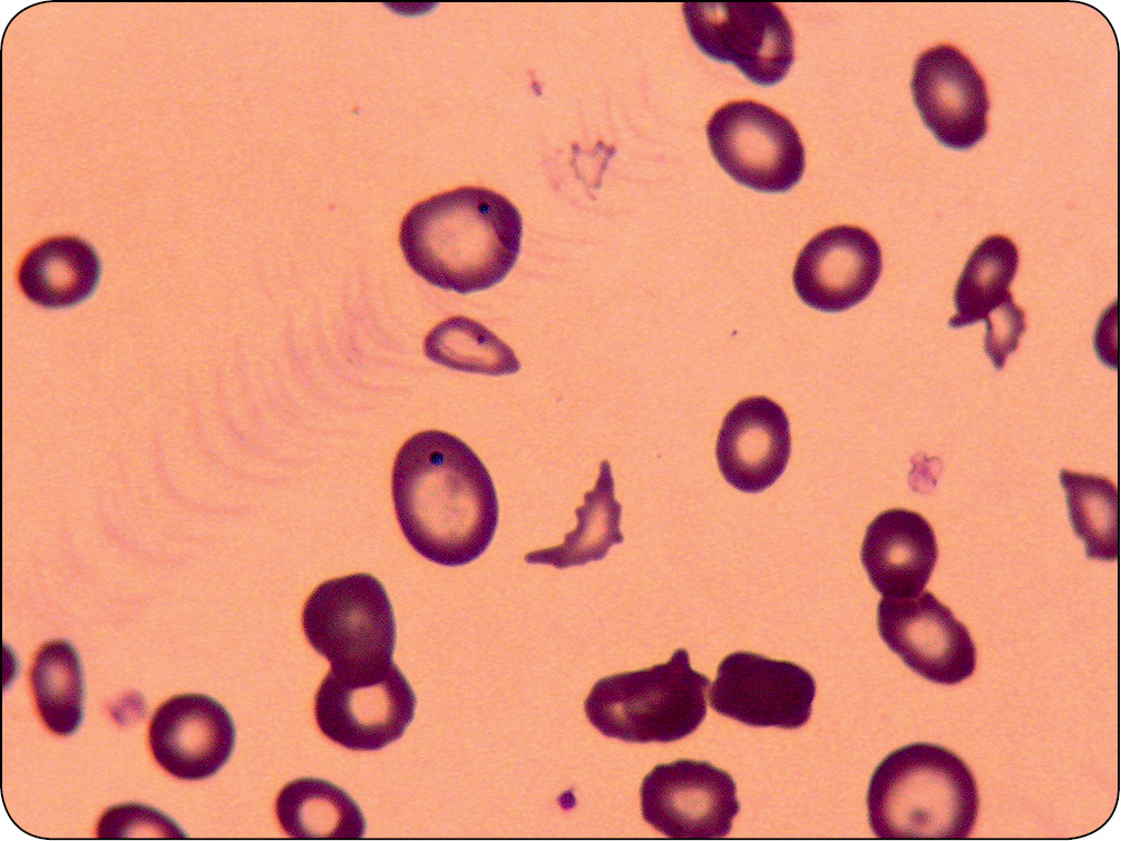 WWP_10_11_Janina_Lukaszewska_ZESPOLY_PARANOWOTWOROWE_RYC_7