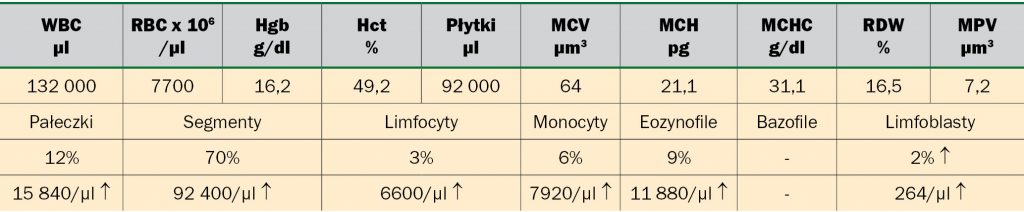 WWP_10_11_Janina_Lukaszewska_ZESPOLY_PARANOWOTWOROWE_TAB_1