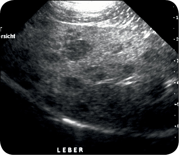 WWP_11-12_11_Sylvia_Wilhelm_GUZ_KOMOREK_TRZUSTKI_Z_PRZERZUTAMI_RYC_4