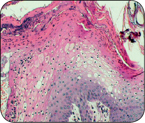 WWP_11-12_11_Sylvia_Wilhelm_GUZ_KOMOREK_TRZUSTKI_Z_PRZERZUTAMI_RYC_5