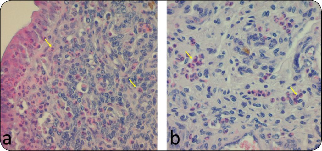 WWT_1_22_SUBKLINICZNE_ENDOMETRITIS_W_STADACH_BYDLA_RYC_3 endometritis