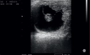 WWT_3_19_Lukasz_Oktawiec_ZAMIERALNOSC_ZARODKOW_DIAGNOSTYKA_LECZENIE_ZAPOBIEGANIE_RYC_2