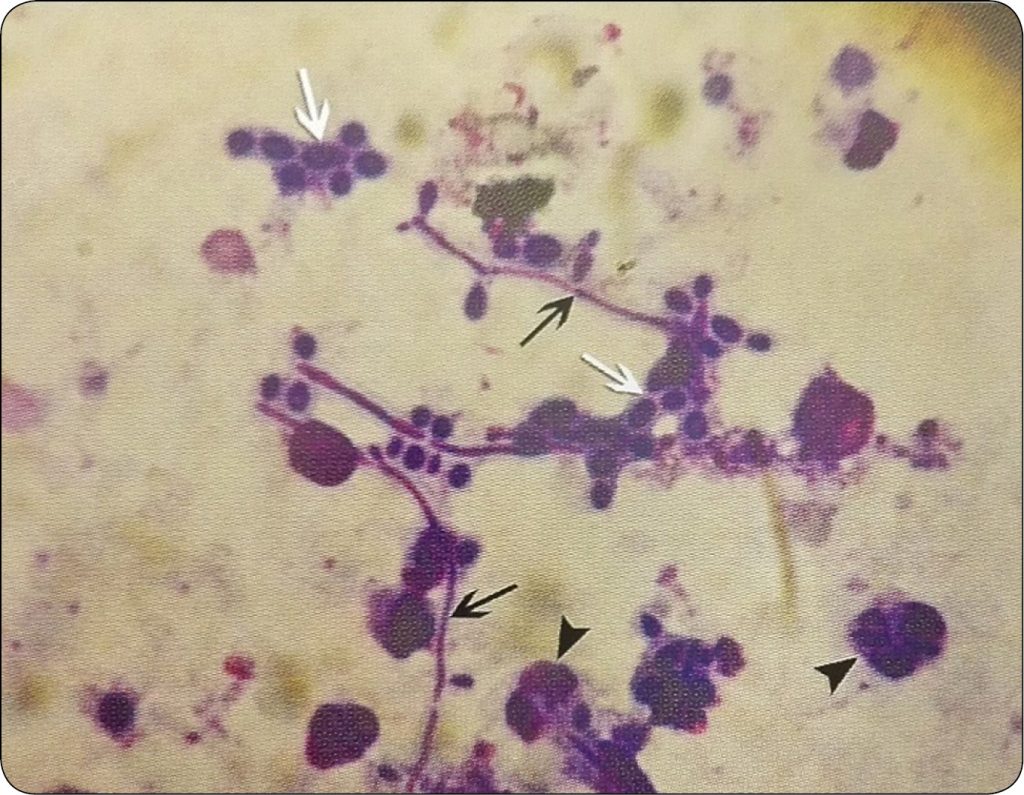 WWT_1_18_Dominika_Domanska_GRZYBICZE_ZAPALENIE_MACICY_U_KLACZY_RYC_2