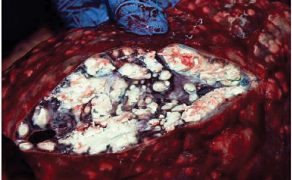WWT_3_18_Lorenzo_Fraile_WSTEP_DO_ALGORYTMOW_DIAGNOSTYCZNYCH_PRZYKLAD_1