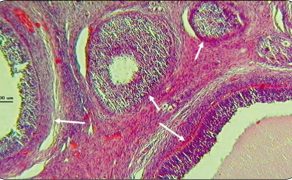 WWT_4_17_STAN_HISTOLOGICZNY_JAJNIKOW_NIEDOJRZAŁYCH_LOSZEK_RYC_1