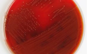 WWT_4_17_Volker_Krömker_ZAPALENIE_WYMIENIA_PRZEZ_STREPTOCOCCUS_UBERIS_RYC_2