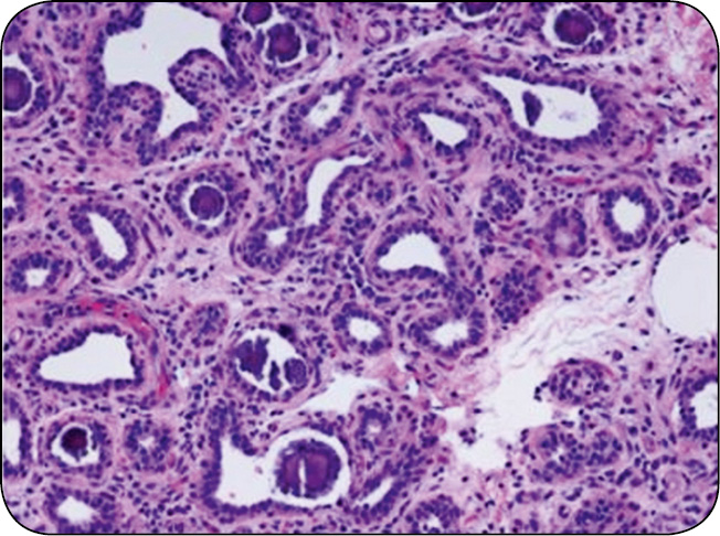 WWT_1_16_Sebastian_Smulski_PROFILAKTYKA_MASTITIS_W_OKRESIE_ZASUSZENIA_KROW_RYC_1_A