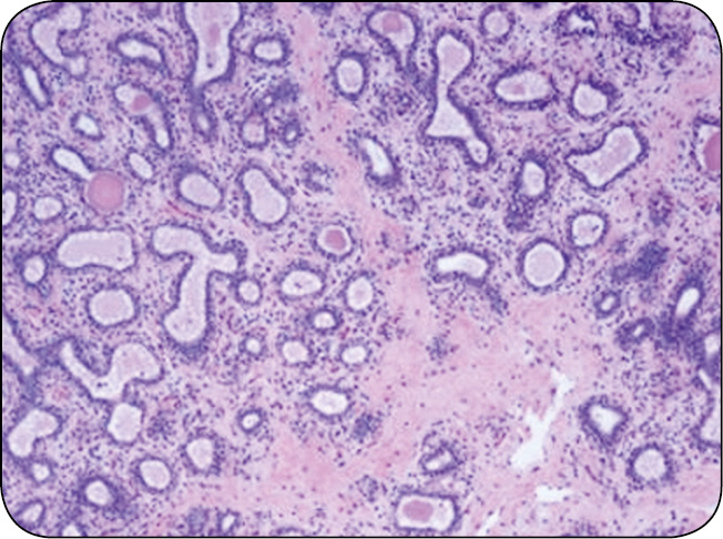 WWT_1_16_Sebastian_Smulski_PROFILAKTYKA_MASTITIS_W_OKRESIE_ZASUSZENIA_KROW_RYC_1_B