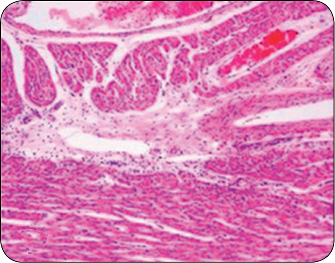 WWT_2_15_Andrea_Luppi_ZAPALENIE_MOZGU_I_MIESNIA_SERCOWEGO_RYC_2_A