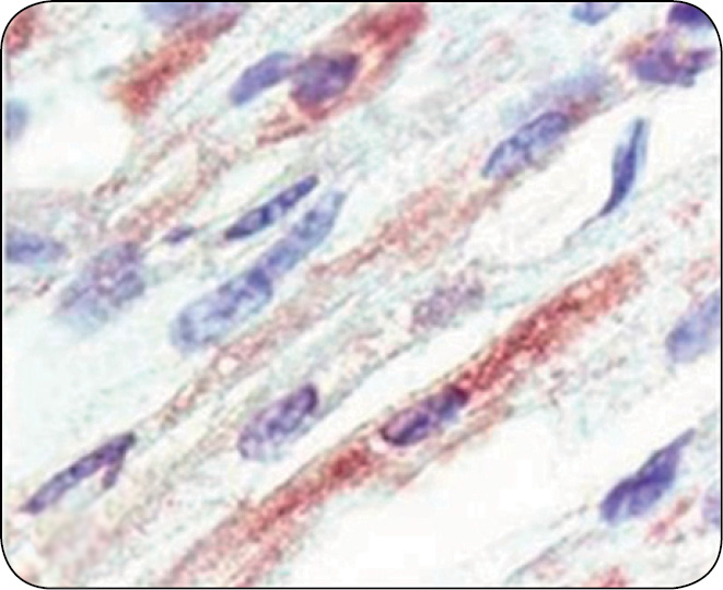 WWT_2_15_Andrea_Luppi_ZAPALENIE_MOZGU_I_MIESNIA_SERCOWEGO_RYC_2_B