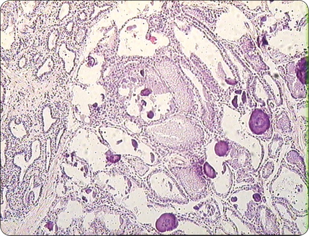 WWT_2_16_Maria_Katkiewicz_MASTITIS_U_KROW_CHORYCH_NA_ENDOMETRIOZE_RYC_2