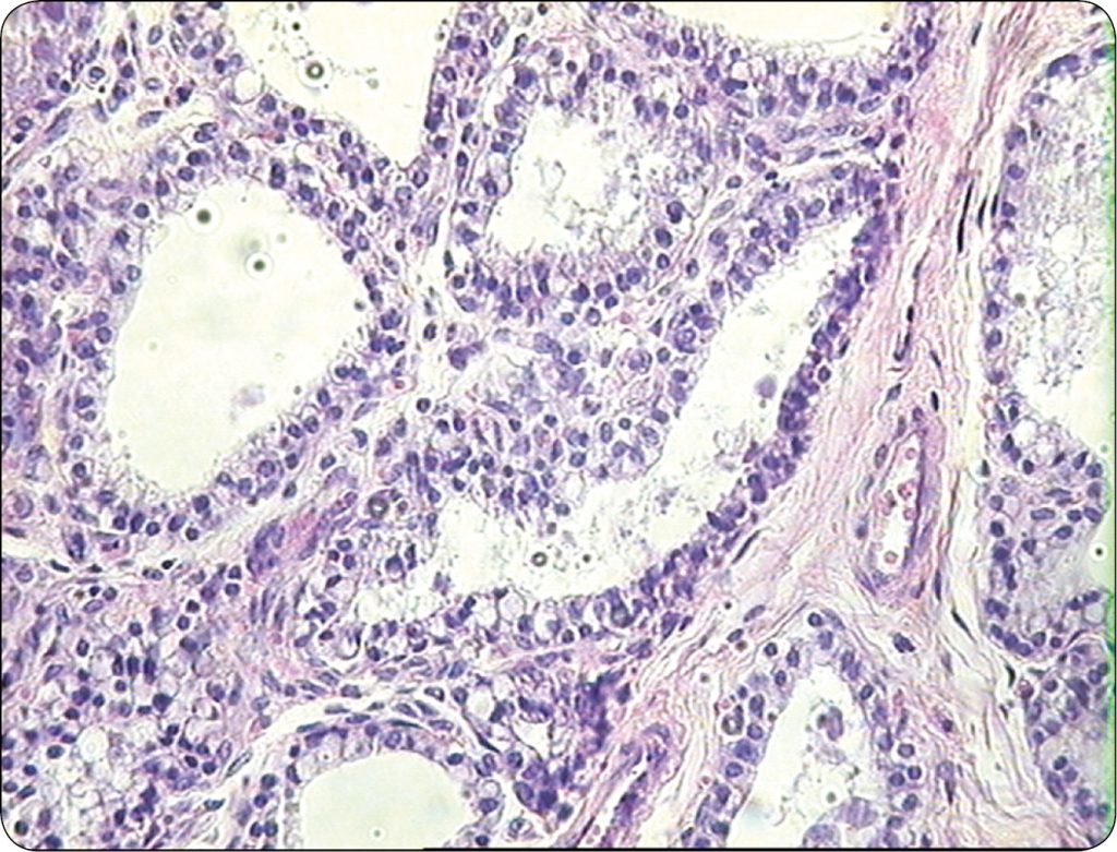 WWT_2_16_Maria_Katkiewicz_MASTITIS_U_KROW_CHORYCH_NA_ENDOMETRIOZE_RYC_3