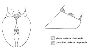 WWT_4_16_Aleksander_Skoracki_ZAPALENIE_SKORY_PALCOW_RYC_1