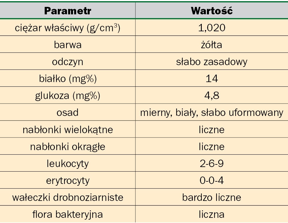 WWP_1-2_10_Marta_Parzeniecka-Jaworska_OBUSTRONNA_ZASTOINOWA_NIEWYDOLNOSC_SERCA_TAB_3